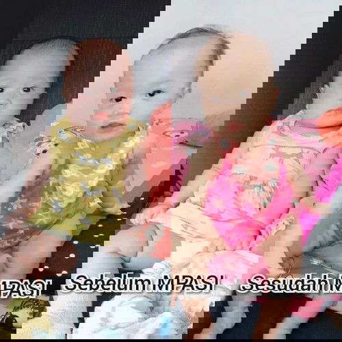 Perbedaan badan anak