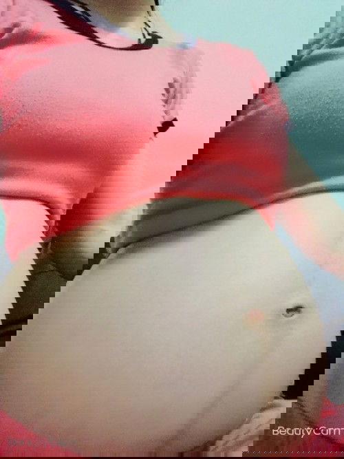 ท้องแม่ๆบ้านไหนไม่มีรอยแตกลายบ้างคะ