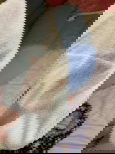 Blood Brownish Discharge
