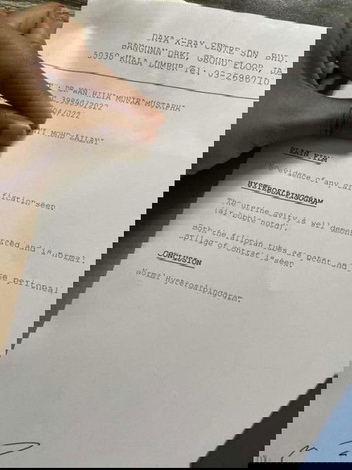 Percubaan untuk hamil