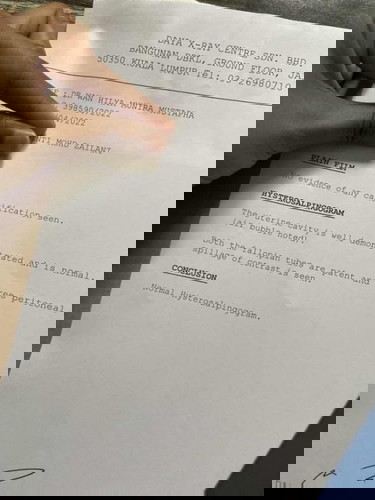 Percubaan untuk hamil