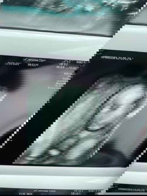 ทีมกันยายน2565