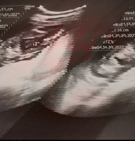 Boy or girl????