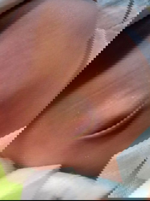 สะดือลูกน้อย