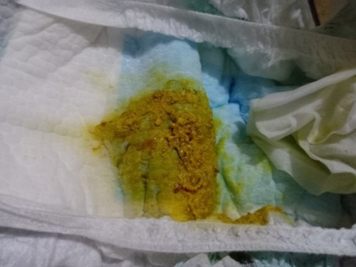 Sa pag dumi ni baby na 7weeks old