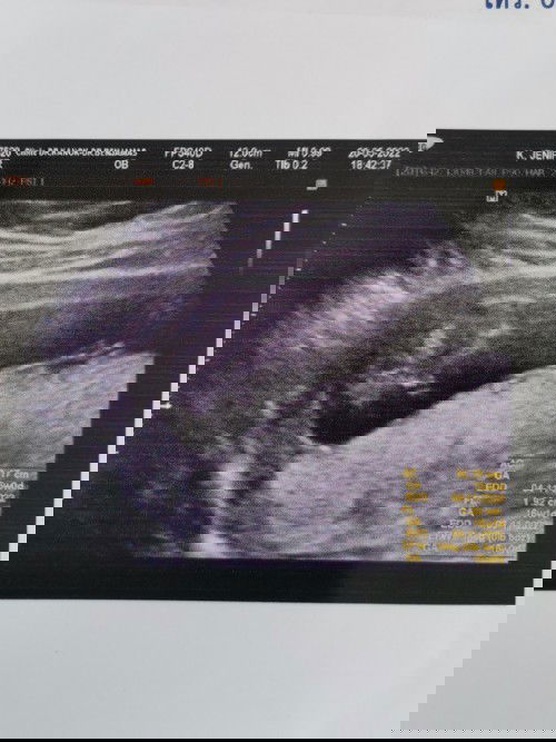 ผู้หญิงหรือผู้ชายคะะ