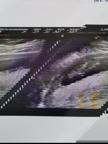 ผู้หญิงหรือผู้ชายคะะ