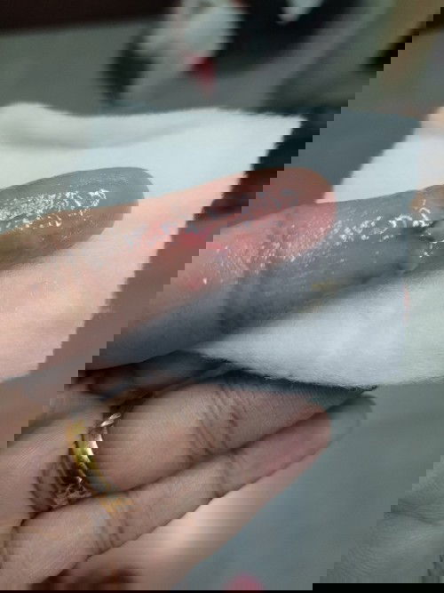 Slm semua... Keluar darah dgn lendir.. 24 minggu 2 hri.   Bahaya ke.. Ada siapa2 pernah alami..