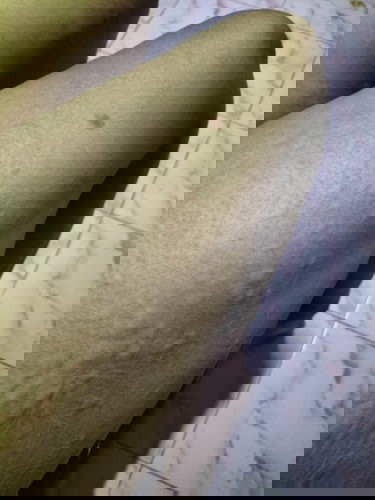 แบบนี้เป็นอะไรอะค่ะ