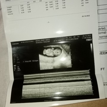11 weeks 💖⭐