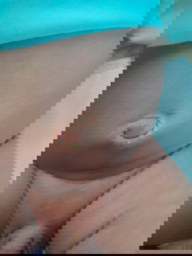 Các mom cho e hỏi rốn như này đã ổn chưa ạ