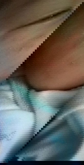 หน้าน้องมีแบบนี้ขึ้น ใช้อะไรถึงจะหายคะ