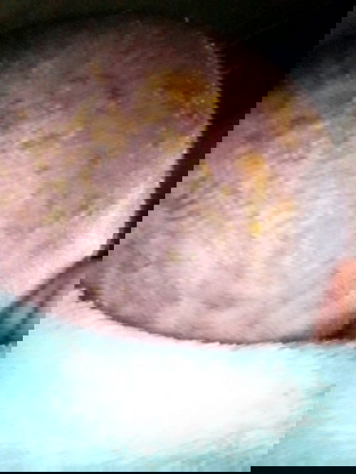 Kulit kepala bayi bernanah