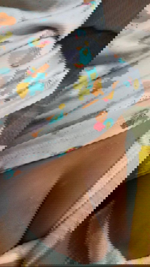 Ne sakit ap ya mam??