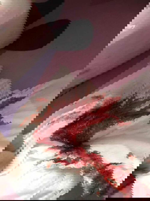 ขอคำปรึกษาเลือดออกหลังคลอด