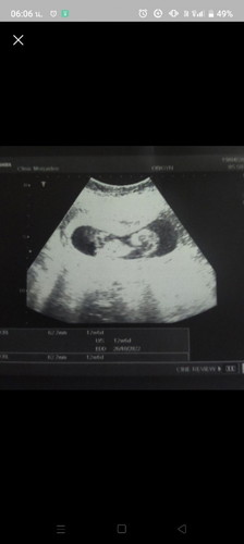 ท้องตอนไม่มีเงินสั่กบ้านตัวผมเองก็เป็นหนี้ติดการพนัน