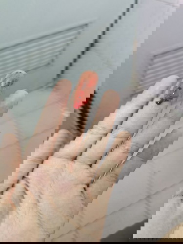 ท้องแล้วมีเลือดออกแบบนี้จะเป็นอะไรไหมค่ะ