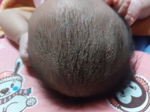 ทำไงหายคะ หัวน้องเป็นแบบนี้