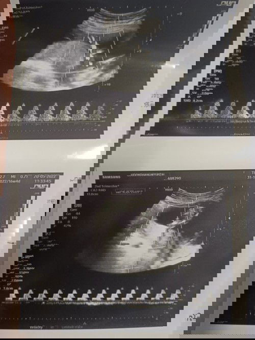 ขอคำแนะนำหน่อยค่ะ