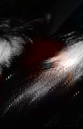 Ask lng poh Kung pano gamut in ganito bukol, two weeks n xa nag antibiotic pero gnun pdin lumalaki p