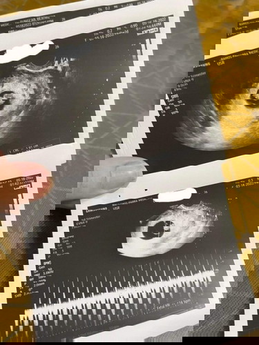 Ultrasound Picture
sharing my 9wks 2days RAINBOW BABY 🌈