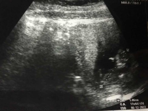 ท้องได้3เดือนนแล้วคะ