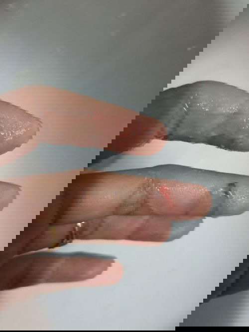 Lendir bersama darah semasa 29 minggu adakah bahaya saya sangat risau.