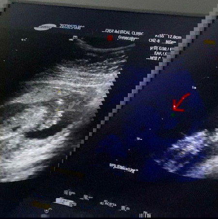 ผู้หญิงใช่มั้ยคะแม่ๆ