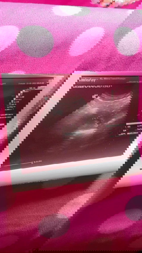 Bunda minta pengalaman nya dong buat nguatin kandungan