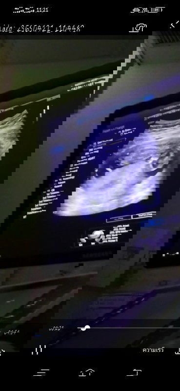 ทีม21ตุลา แม่ๆบ้านไหนคลอดเดือนนี้บ้างค่ะและบ้านไหนดิ้นเก่งบ้างค่ะบ้านนี้ยังไม่ค่อยรู้สึกเลยค่ะ