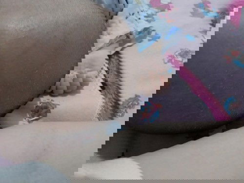 Bunda ada yg tau cara hilangkan kulit kepala bayi yg seperti ketombe sehabis cukur rambut 40hr