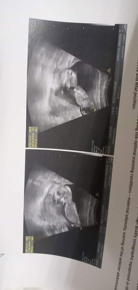 15wแล้วค๊าาาาา อย่าลืมดูแลสุขภาพกันด้วยนะคะแม่ๆ🥰❤️