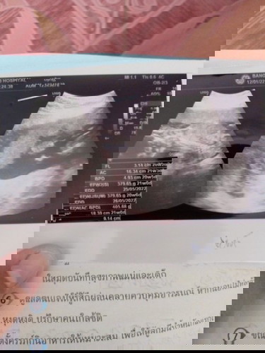 ภายขวามือคือภาพอะไรคะ