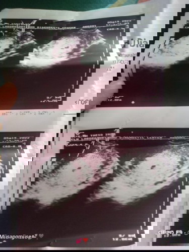 Nakakakaba Pero Positive lang Pray always 😇🙏 😔