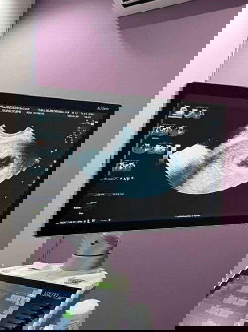 Praying for my Baby Heartbeat 🙏🏼🙏🏼