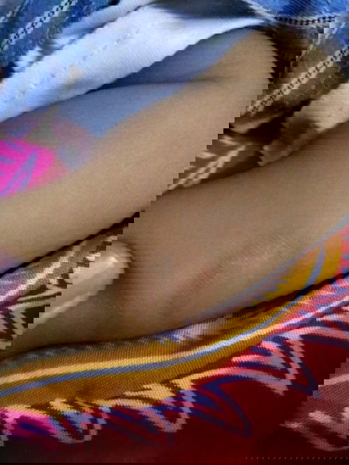 Kulit kering seperti gatal-gatal