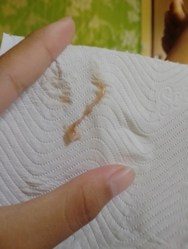 อยากรู้ว่าท้องจริงรึเปล่า