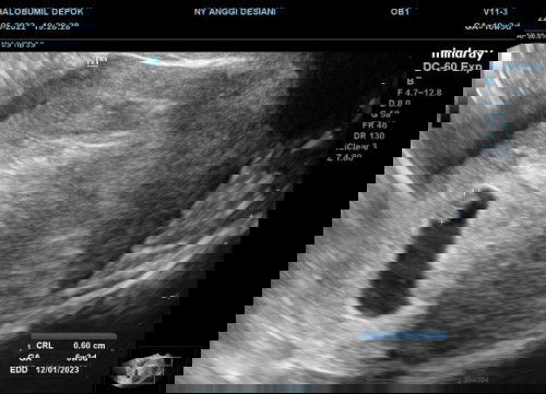 Tanya seputar kehamilan