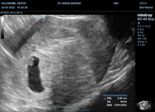 Tanya seputar kehamilan