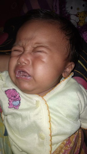 Bun kenapa ya bibir anak saya sperti itu?
Sudah 2 hari seperti itu?
Dikasih obat apa ya bun?