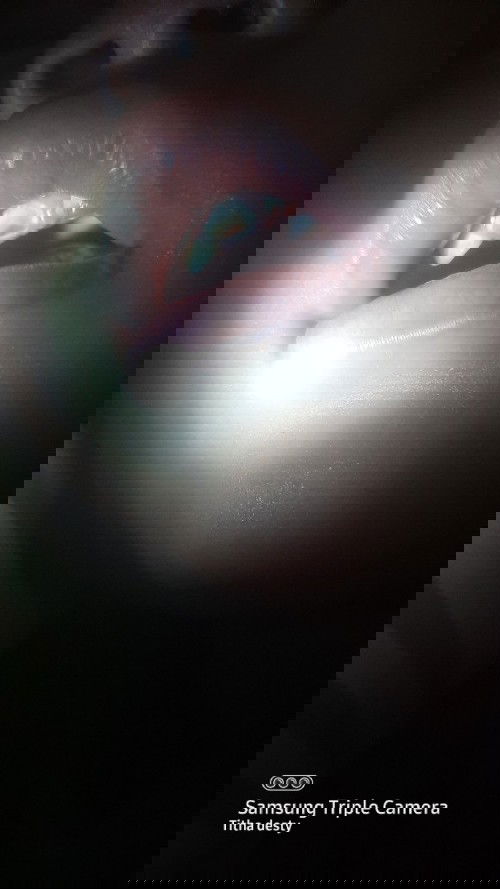 Gigi anak patah dan terlihat gusi dr dalam sisa gigi