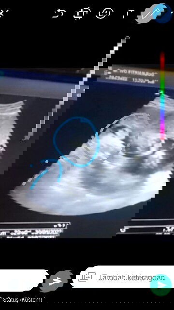 Bun bantu jawab donk