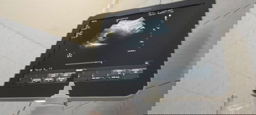 Berbagi pengalaman part 2