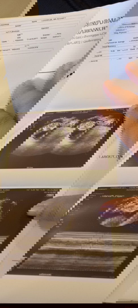 Pls check kung ok lang baby ko