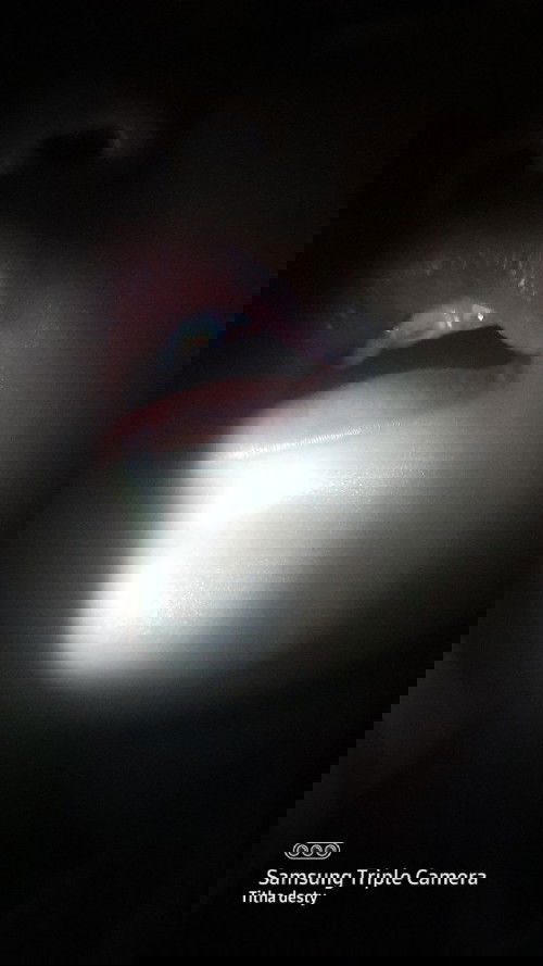 Gigi anak patah separuh terlihat gusi