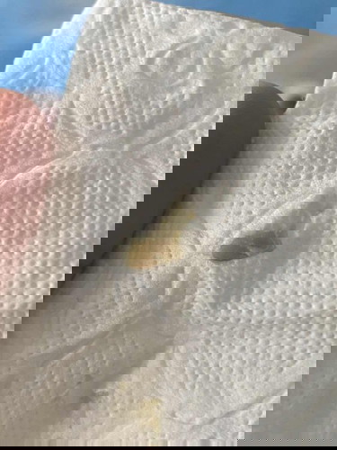 ตกขาวแบบนี้อันตรายไหมคะ