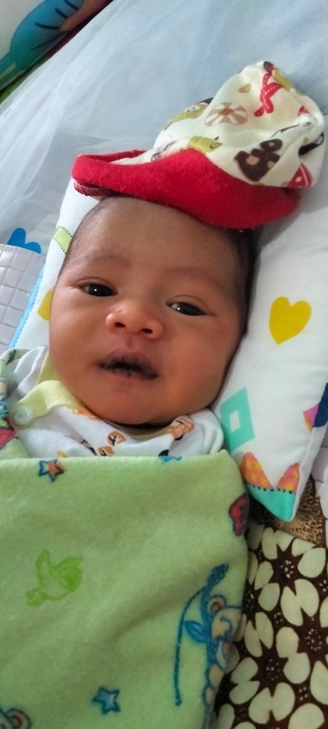 Bibir bayi hitam dan kering