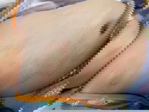 Kulit ruam dan kasar