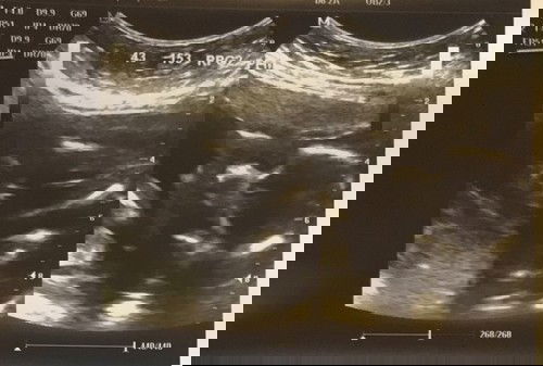 Gender: Probable Female