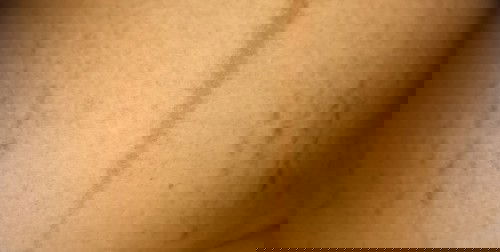 Garis² hitam di kiri kanan perut